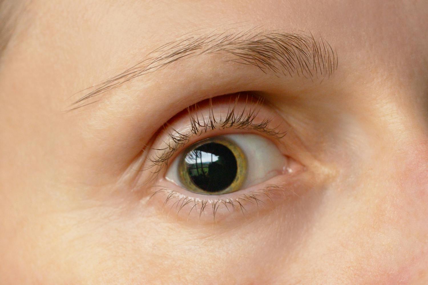 Pupille dilatée : quelles causes ? Quand s'inquiéter ?