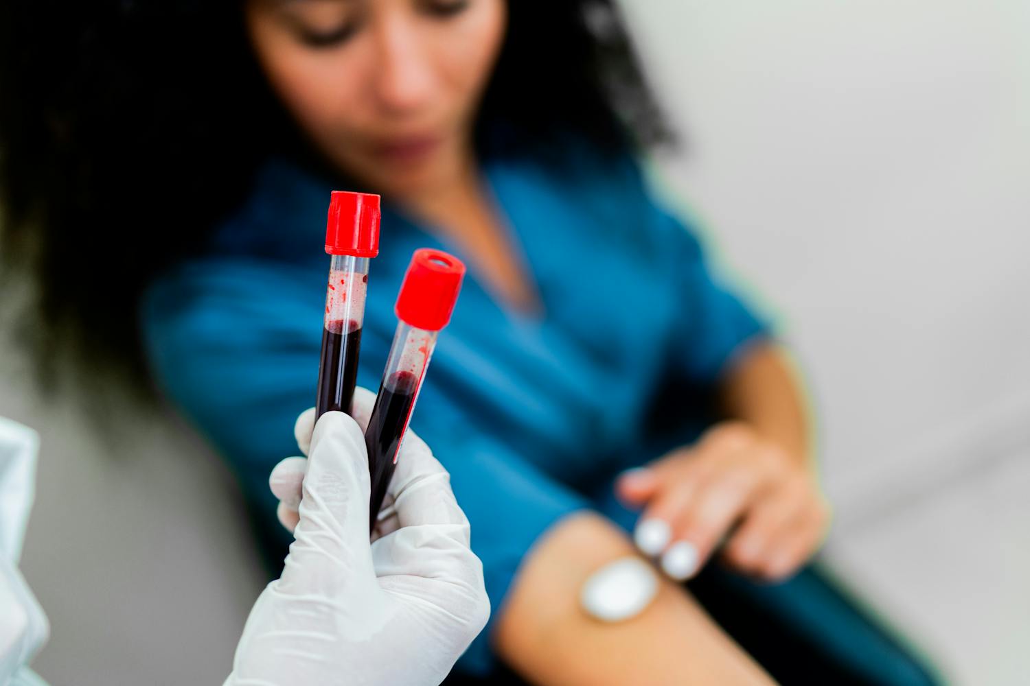 Trop de globules rouges dans le sang : faut-il s'inquiéter ?